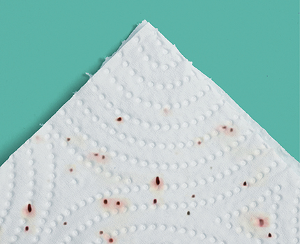 Loppe-afføringstest